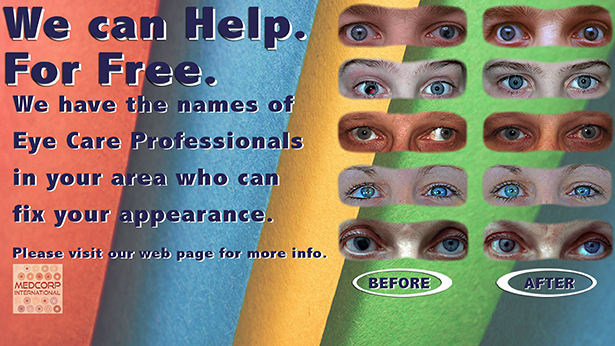 free-disfigured-eye-help-blog