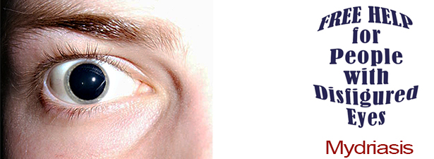 mydriasis-disfigured-eye-help